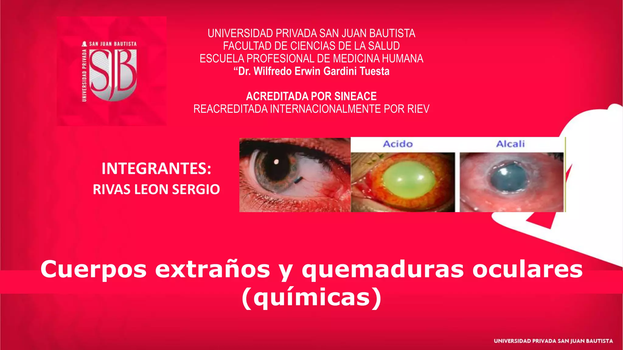 Cuerpos extraños y quemaduras quimicas oculares.pptx