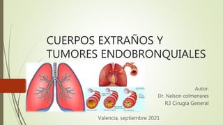 CUERPOS EXTRAÑOS Y
TUMORES ENDOBRONQUIALES
Autor:
Dr. Nelson colmenares
R3 Cirugía General
Valencia, septiembre 2021
 