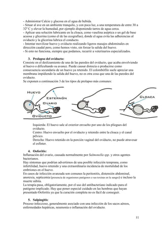 11
- Administrar Calcio y glucosa en el agua de bebida.
- Situar al ave en un ambiente tranquilo, y con poca luz, a una temperatura de entre 30 a
32º C y elevar la humedad, por ejemplo disponiendo tarros de agua cerca.
- Aplicar una solución lubricante en la cloaca, como vaselina aséptica o un gel de base
acuosa y glicerina (como el de las ecografías), donde el agua evita las adherencias al
oviducto y la glicerina lubrica el conducto.
- Intentar movilizar huevo y oviducto realizando ligeros masajes abdominales en
dirección caudal pero, como hemos visto, sin forzar la salida del huevo.
- Si esto no funciona, siempre que podamos, recurrir a veterinarios especializados.
3. Prolapso del oviducto:
Consiste en el deslizamiento de una de las paredes del oviducto, que acaba envolviendo
al huevo o dificultando su avance. Puede causar distocia o producirse como
consecuencia secundaria de un huevo ya retenido. El colombófilo suele apreciar una
membrana impidiendo la salida del huevo, no es otra cosa que una de las paredes del
oviducto.
Se exponen a continuación 3 de los tipos de prolapso más comunes:
Izquierda: El huevo sale al exterior envuelto por uno de los pliegues del
oviducto.
Centro: Huevo envuelto por el oviducto y retenido entre la cloaca y el canal
pélvico.
Derecha: Huevo retenido en la porción vaginal del oviducto, no puede atravesar
el esfínter.
4. Ooforitis:
Inflamación del ovario, causada normalmente por Salmonella spp. y otros agentes
bacterianos.
Hay síntomas que podrían advertirnos de una posible infección temprana, como
infertilidad, huevo retenido y una extraordinaria incidencia de mortalidad de los
embriones en el huevo.
En casos de infección avanzada son comunes la peritonitis, distensión abdominal,
anorexia, septicemia (presencia de organismos patógenos o sus toxinas en la sangre) e incluso la
muerte súbita.
La terapia pasa, obligatoriamente, por el uso del antibacteriano indicado para el
patógeno implicado. Hay que poner especial cuidado en las hembras que hayan
presentado Ooforitis ya que la curación completa no es fácil de conseguir.
5. Salpingitis:
Proceso infeccioso, generalmente asociado con una infección de los sacos aéreos,
enfermedades hepáticas, neumonía o inflamación del oviducto.
 