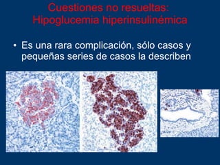 Cuestiones no resueltas :  Hipoglucemia hiperinsulinémica Es una rara complicación, sólo casos y pequeñas series de casos la describen 