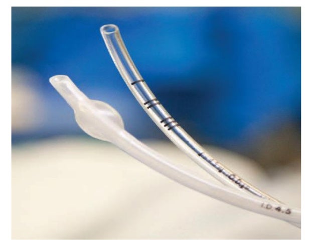 Uncuffed Et Tube Size Pediatrics – TFJCFZ