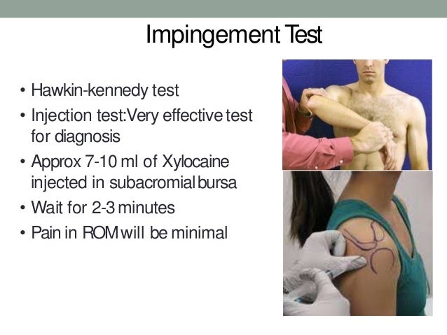 torn rotator cuff test