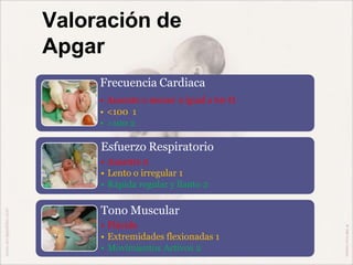Valoración de
Apgar
Frecuencia Cardiaca
• Ausente o menor o igual a 60 0
• <100 1
• >100 2
Esfuerzo Respiratorio
• Ausente 0
• Lento o irregular 1
• Rápida regular y llanto 2
Tono Muscular
• Flácido
• Extremidades flexionadas 1
• Movimientos Activos 2
 