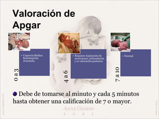 Valoración de
Apgar
0
a
3
• UrgenciaMedica.
Reanimación
Avanzada.
4
a
6
• Requiere Aspiración de
secreciones, estimulación
y re valoración posterior.
7
a
10
• Normal
Debe de tomarse al minuto y cada 5 minutos
hasta obtener una calificación de 7 o mayor.
 