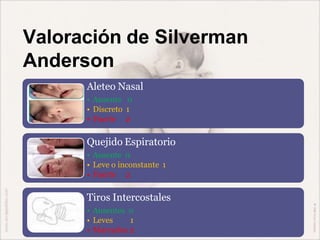 Valoración de Silverman
Anderson
Aleteo Nasal
• Ausente 0
• Discreto 1
• Fuerte 2
Quejido Espiratorio
• Ausente 0
• Leve o inconstante 1
• Fuerte 2
Tiros Intercostales
• Ausentes 0
• Leves 1
• Marcados 2
 