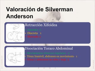Valoración de Silverman
Anderson
Retracción Xifoidea
• Ausente 0
• Discreta 1
• Marcada 2
Disociación Toraco Abdominal
• Movimientos rítmicos regulares 0
• Tórax Inmóvil, abdomen en movimiento 1
• Tórax y abdomen en sube y baja 2
 