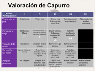 Valoración de Capurro
Criterio /
Puntaje (días)
0 5 10 15 20
Textura de la
piel
Gelatinosa Fina y Lisa Gruesa con
descamación
superficial
Descamación en
manos y pies
Aparienciacon
grietas
profundas
Forma de la
oreja
Sin Forma
Plana
0
Encorvamiento de
menos de la mitad
del hélixauricular
8
Encorvamiento
de la parte
superior del
hélix
16
Pabellón
totalmente
Encorvado
24
Tamaño de la
mama
No palpable Palpable menor
a 5mm.
Palpable de 5 a
10 mm.
Palpablemayor
a 10mm.
Formación
del pezón
Apenas visiblesin
aereola
Pezón bien
definido, aereola
liza y chata D=< 7
a 5 mm.
Pezón bien
definido Aereola
punteada,borde
levantado,
D=<7.5mm
Pezón bien
definido Aereola
punteada,borde
levantado
D=>7.5mm.
Pliegues
plantares
Sin Pliegues Pliegues mal
definidos enla
mitad anterior
Pliegues bien
definidos en mitad
anterior y sucosen
tercio anterior
Surcos en mitad
anterior.
Surcos en mas
de la mitad
anterior.
 