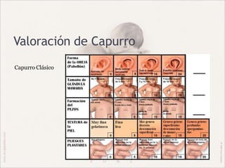 Valoración de Capurro
Capurro Clásico
 
