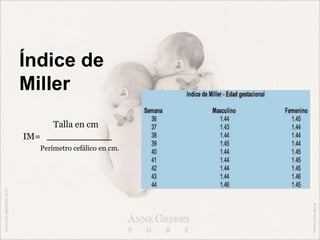 Índice de
Miller
Talla en cm
IM=
Perímetro cefálico en cm.
 