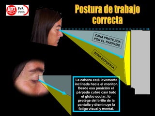 La cabeza está levemente
inclinada hacia el monitor.
Desde esa posición el
párpado cubre casi todo
el globo ocular, lo
protege del brillo de la
pantalla y disminuye la
fatiga visual y mental.
ZONA PROTEJIDA
POR EL PÁRPADO
ZONA
EXPUESTA
 