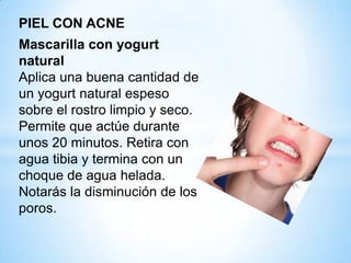 PIEL CON ACNE
Mascarilla con yogurt
natural
Aplica una buena cantidad de
un yogurt natural espeso
sobre el rostro limpio y seco.
Permite que actúe durante
unos 20 minutos. Retira con
agua tibia y termina con un
choque de agua helada.
Notarás la disminución de los
poros.

 