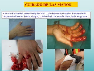 Y en un día normal, como cualquier otro…, un descuido y objetos, herramientas,
materiales diversos, hasta el agua, pueden lesionar ocasionando lesiones graves.
CUIDADO DE LAS MANOS
 