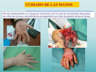 Por dar mantenimiento a un equipo en movimiento, por no usar las herramientas adecuadas,
por violar las normas y procedimientos de seguridad o por tratar de ganarle tiempo al tiempo.
CUIDADO DE LAS MANOS
 