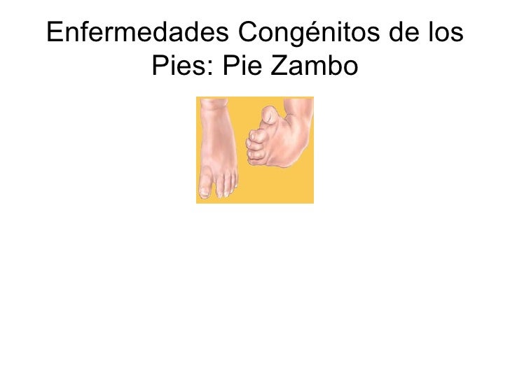 Se librará rápidamente del hongo sobre las uñas