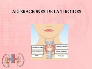 ALTERACIONES DE LA TIROIDES
 