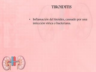 TIROIDITIS

• Inflamación del tiroides, causado por una
  infección vírica o bacteriana.
 