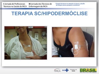 TERAPIA SC/HIPODERMÓCLISE
 