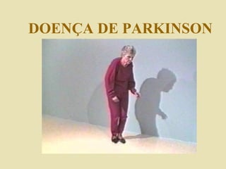 DOENÇA DE PARKINSON 