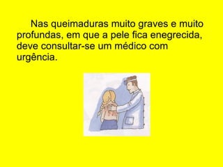 Nas queimaduras muito graves e muito profundas, em que a pele fica enegrecida, deve consultar-se um médico com urgência. 