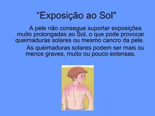 “Exposição ao Sol" A pele não consegue suportar exposições muito prolongadas ao Sol, o que pode provocar queimaduras solares ou mesmo cancro da pele.  As queimaduras solares podem ser mais ou menos graves, muito ou pouco extensas. 