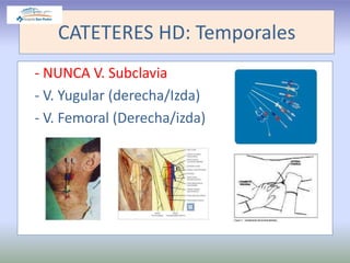 CATETERES HD: Temporales
- NUNCA V. Subclavia
- V. Yugular (derecha/Izda)
- V. Femoral (Derecha/izda)
 
