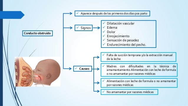 Implanty venderé el pecho