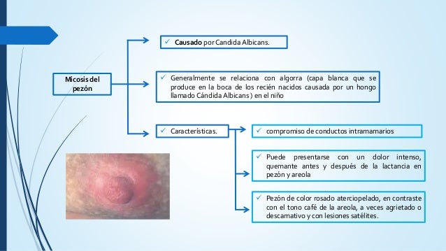 succión pezones rosados succión pezones rosados