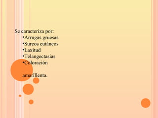 Se caracteriza por:
•Arrugas gruesas
•Surcos cutáneos
•Laxitud
•Telangectasias
•Coloración
amarillenta.
 