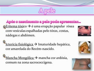 A pele

Eritema tóxico  é uma erupção papular rósea
com vesículas espalhadas pelo tórax, costas,
nádegas e abdómen.

Icterícia fisiológica  Imaturidade hepática,
cor amarelada do Recém-nascido.

Mancha Mongólica  mancha cor ardósia,
comum na zona sacrococcígena.
 