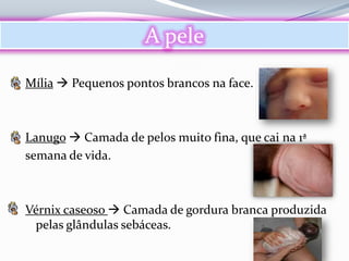 A pele

Mília  Pequenos pontos brancos na face.



Lanugo  Camada de pelos muito fina, que cai na 1ª
semana de vida.



Vérnix caseoso  Camada de gordura branca produzida
 pelas glândulas sebáceas.
 