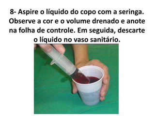 8- Aspire o líquido do copo com a seringa.
Observe a cor e o volume drenado e anote
na folha de controle. Em seguida, descarte
o líquido no vaso sanitário.
 
