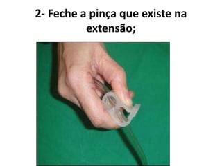 2- Feche a pinça que existe na
extensão;
 
