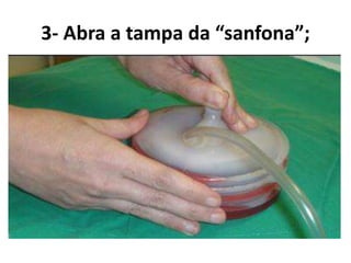 3- Abra a tampa da “sanfona”;
 