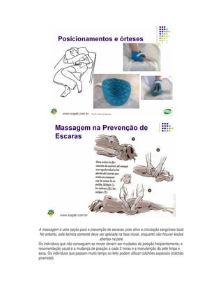 A massagem é uma opção para a prevenção de escaras, pois ativa a circulação sangüínea local.
No entanto, esta técnica somente deve ser aplicada na fase inicial, enquanto não houver lesões
abertas na pele.
Os indivíduos que não conseguem se mover devem ser mudados de posição freqüentemente; a
recomendação usual é a mudança de posição a cada 2 horas e a manutenção da pele limpa e
seca. Os indivíduos que passam muito tempo ao leito podem utilizar colchões especiais (colchão
piramidal).
 