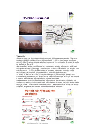 Tratamento
O tratamento de uma úlcera de decúbito é muito mais difícil que a sua prevenção. Felizmente,
nos estágios iniciais, as úlceras de decúbito geralmente cicatrizam por si após a pressão ser
removida. Quando a pele se rompe, a proteção da mesma com um curativo de gaze pode ajudar
na cicatrização (Dersani).
Quando a úlcera parece estar infectada ou é exsudativa, a lavagem delicada com sabão ou o
uso de desinfetantes pode remover o material morto e infectado. No entanto, uma lavagem muito
enérgica retarda a cicatrização. Algumas vezes, em casos mais graves, o médico precisa
remover (debridar) o material morto prevenindo a disseminação de infecções.
As úlceras de decúbito profundas são de difícil tratamento e algumas vezes, elas exigem o
transplante de pele saudável para a zona lesada. Infelizmente, esse tipo de cirurgia nem sempre
é possível, sobretudo nos indivíduos idosos, frágeis e desnutridos.
Freqüentemente, quando ocorrem infecções mais profundas em uma úlcera, antibióticos são
administrados. Quando os ossos localizados abaixo de uma úlcera são infectados, a osteomielite
(infecção óssea) é extremamente difícil de ser curada e pode disseminar-se através da corrente
sangüínea, exigindo muitas semanas de tratamento com um antibiótico.
 