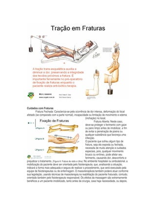 Cuidados com Fraturas
Fratura Fechada: Caracteriza-se pela ocorrência de dor intensa, deformação do local
afetado (se comparado com a parte normal), incapacidade ou limitação de movimento e edema
(inchação) no local;
Fratura Aberta: Neste caso,
deve-se proteger o ferimento com gaze
ou pano limpo antes de imobilizar, a fim
de evitar a penetração de poeira ou
qualquer substância que favoreça uma
infecção.
O paciente que sofreu algum tipo de
fratura, seja ela exposta ou fechada,
necessita de muita atenção e cuidados
especiais, pois, qualquer movimento
brusco ou errôneo, pode afetar seu
ferimento, causando dor, desconforto e
prejudicar o tratamento. (Figura A: Fratura de rádio e Ulna); No ambiente hospitalar ou ambulatorial, a
mobilização do paciente deve ser orientada pelo fisioterapeuta, que, analisando a situação,
indicará a forma mais adequada e segura de realizar o procedimento, que será executado pela
equipe de fisioterapeutas ou de enfermagem. O massoterapêuta também poderá atuar conforme
sua legislação, usando técnicas de massoterapia,na reabilitação do paciente fraturado, contudo,
orientado também pelo fisioterapeuta responsável. Os efeitos da massagem são extremamente
benéficos a um paciente imobilizado, tanto antes da cirurgia, casa haja necessidade, ou depois.
 