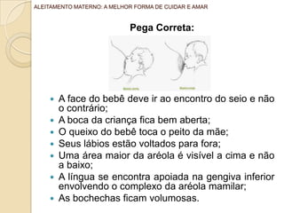 Pega Correta:
 A face do bebê deve ir ao encontro do seio e não
o contrário;
 A boca da criança fica bem aberta;
 O queixo do bebê toca o peito da mãe;
 Seus lábios estão voltados para fora;
 Uma área maior da aréola é visível a cima e não
a baixo;
 A língua se encontra apoiada na gengiva inferior
envolvendo o complexo da aréola mamilar;
 As bochechas ficam volumosas.
ALEITAMENTO MATERNO: A MELHOR FORMA DE CUIDAR E AMAR
 