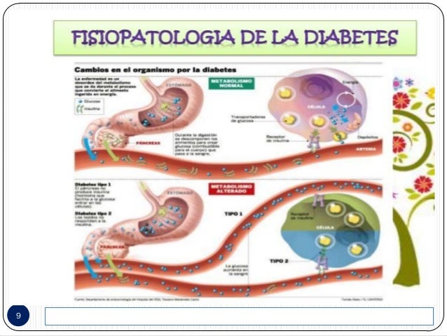 Cuidados de enf. en diabetes mellitus Cuidados de enf. en diabetes mellitus