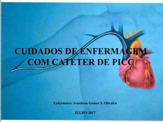 CUIDADOS DE ENFERMAGEM
COM CATETER DE PICC
Enfermeiro: Ivanilson Gomes S. Oliveira
JULHO 2017
 