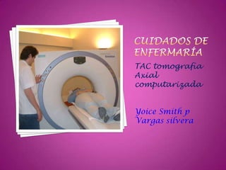 TAC tomografía
Axial
computarizada
Yoice Smith p
Vargas silvera
 