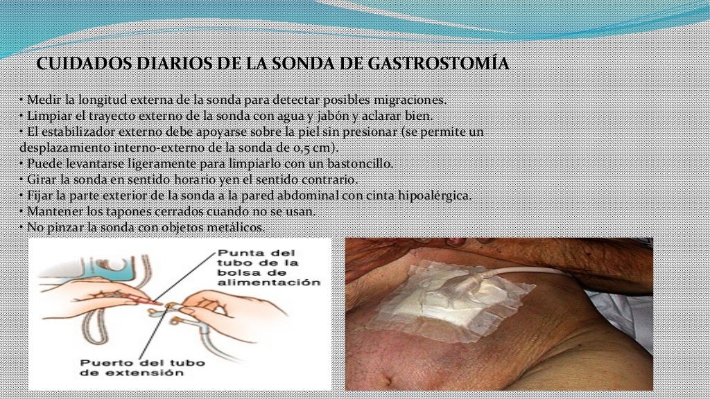 Cuidados de enfermería a la persona con afecciones gastrointestinales