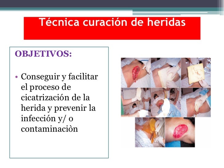 Cuidados de enfermerìa en las heridas_ACanoM
