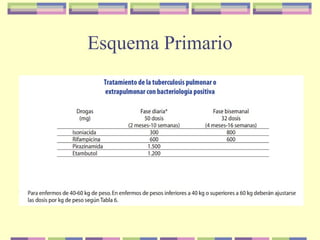 Esquema Primario
 