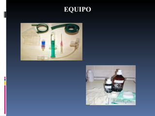 EQUIPO 