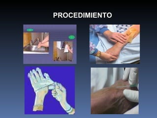 PROCEDIMIENTO 