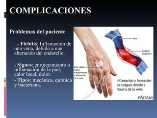 COMPLICACIONES   Problemas del paciente -  Flebitis : Inflamación de una vena, debido a una alteración del endotelio. -  Signos : enrojecimiento o inflamación de la piel, calor local, dolor. -  Tipos : mecánica, química y bacteriana. 