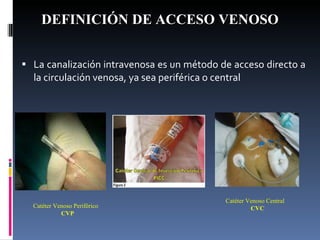 DEFINICIÓN DE ACCESO VENOSO La canalización intravenosa es un método de acceso directo a la circulación venosa, ya sea periférica o central Catéter Venoso Periférico CVP Catéter Venoso Central CVC 