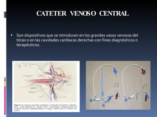 CATETER VENOSO CENTRAL Son dispositivos que se introducen en los grandes vasos venosos del tórax o en las cavidades cardiacas derechas con fines diagnósticos o terapéuticos. 