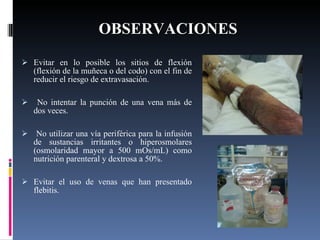 OBSERVACIONES Evitar en lo posible los sitios de flexión (flexión de la muñeca o del codo) con el fin de reducir el riesgo de extravasación.  No intentar la punción de una vena más de dos veces.   No utilizar una vía periférica para la infusión de sustancias irritantes o hiperosmolares (osmolaridad mayor a 500 mOs/mL) como nutrición parenteral y dextrosa a 50%.   Evitar el uso de venas que han presentado flebitis. 