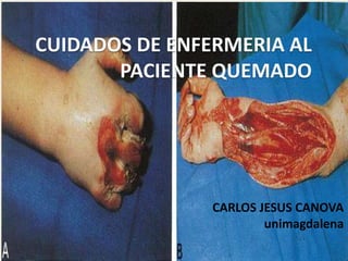CUIDADOS DE ENFERMERIA AL
       PACIENTE QUEMADO




                CARLOS JESUS CANOVA
                        unimagdalena
 